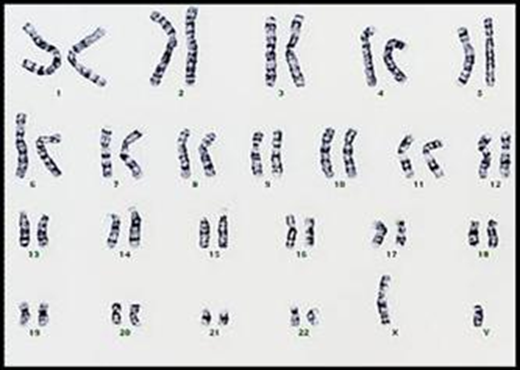 遺伝子・染色体検査
      Gene chromosome