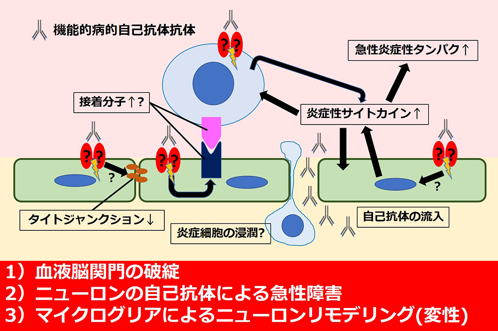 取り組んでいる研究 研究活動 膠原病 感染内科 北里大学病院