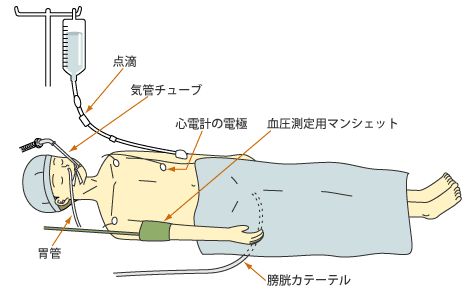 麻酔 全身 全身麻酔を受けたことがある方へ