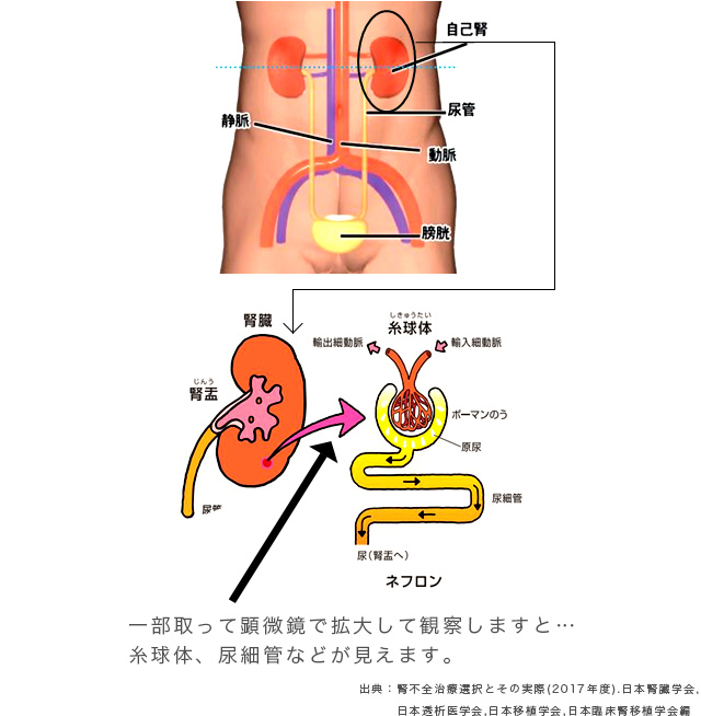 腎臓病の概要