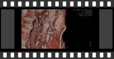 OPCAB㑢e-3DCT-1